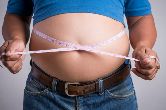 Obesity